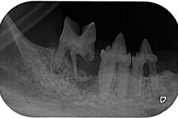 Dental X-ray showing dog teeth and jaw structure.