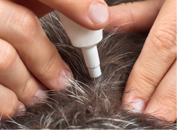A close-up of a person applying flea treatment to a pet’s skin by parting the fur and using a treatment applicator.