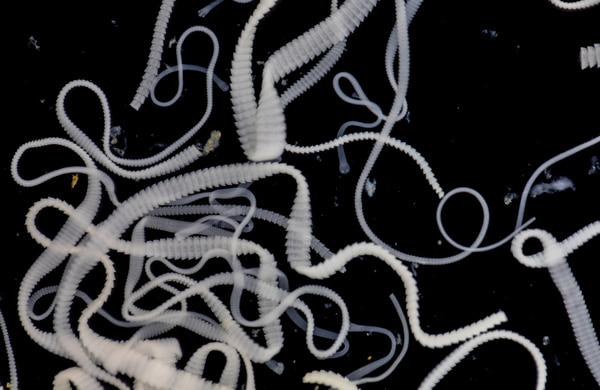 A close-up image of white tapeworms tangled together against a black background in a laboratory setting.